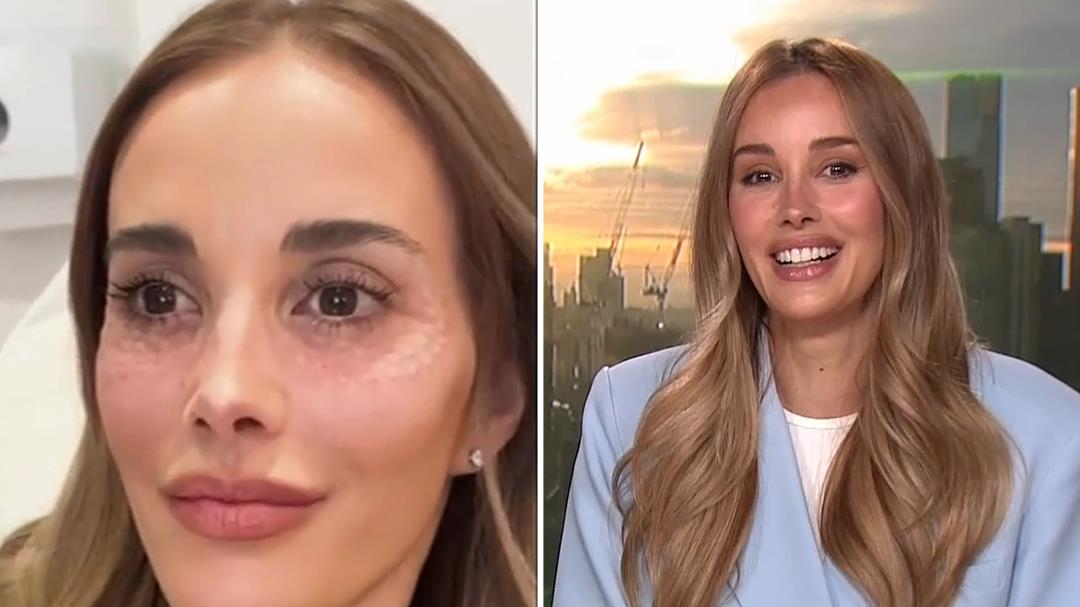 Bec Judd gets candid about beauty treatments